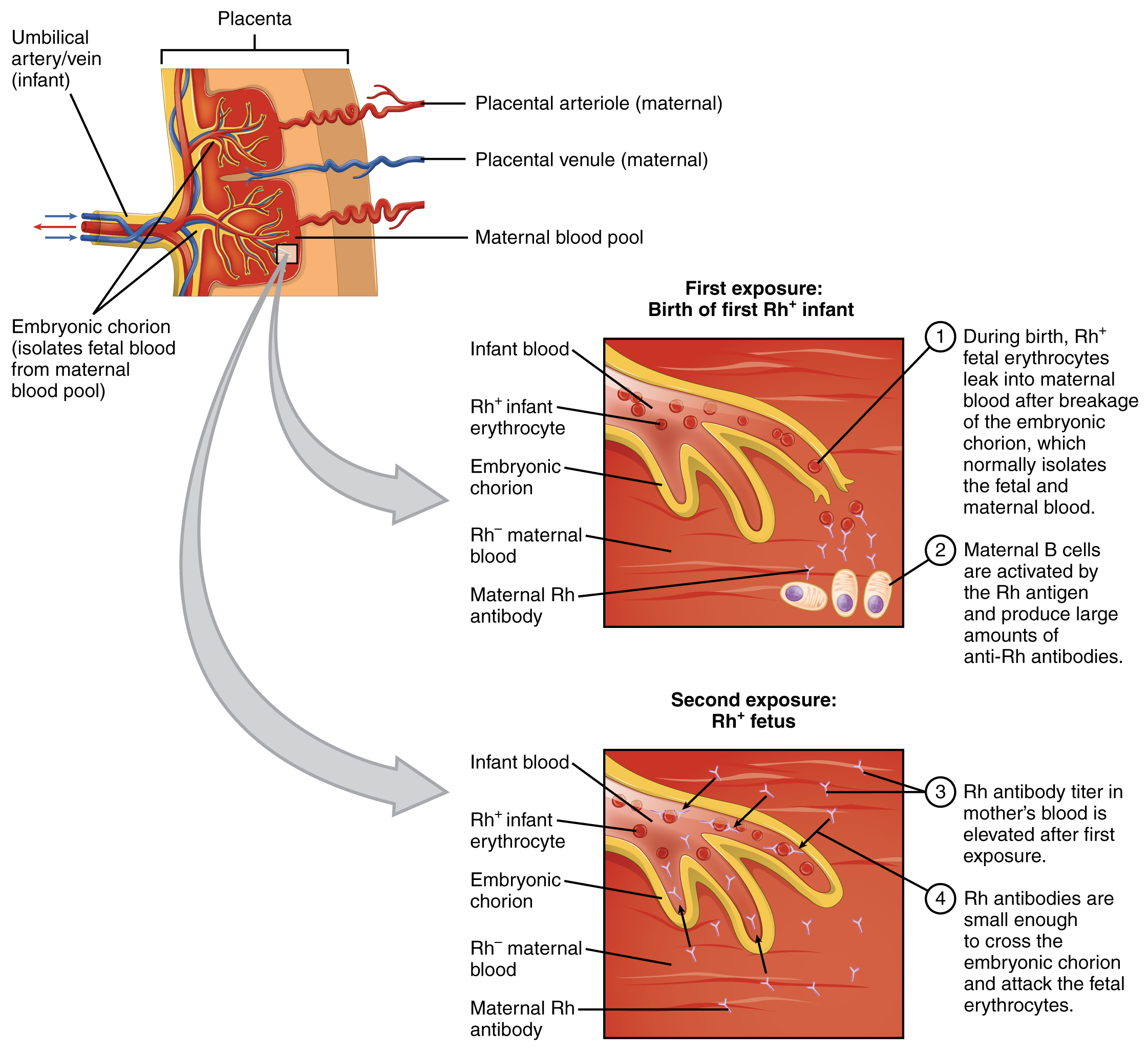 Mechanisms of erythroblastosis fetalis