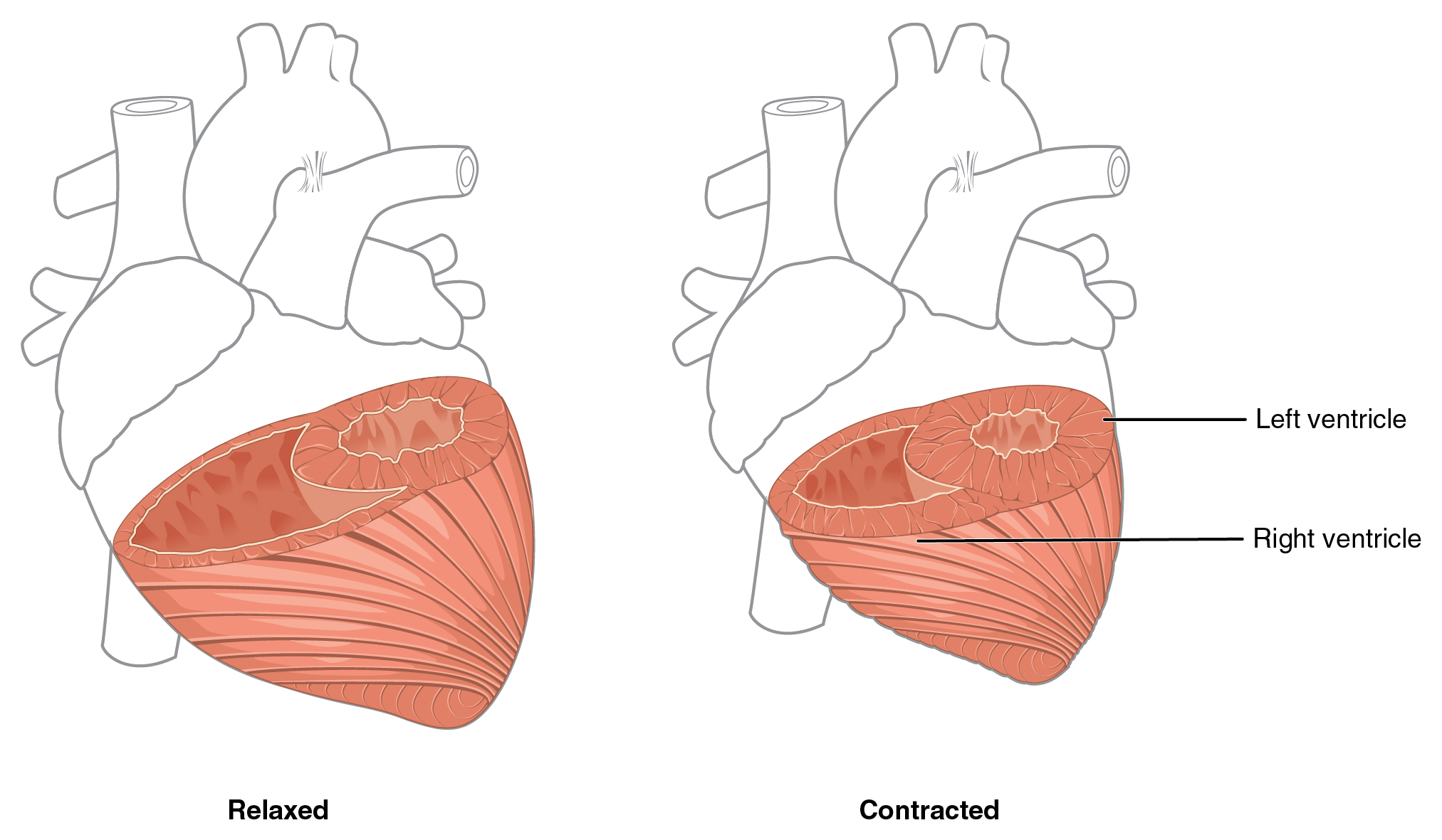 Diagram comparing the thickness of the myocardium in both the left and right ventricles. The myocardium of the left ventricle is significantly thicker to produce a stronger force to push the blood to the furthest destinations in the systemic circuit.
