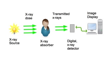 x-ray-image-creation-and-display.jpg