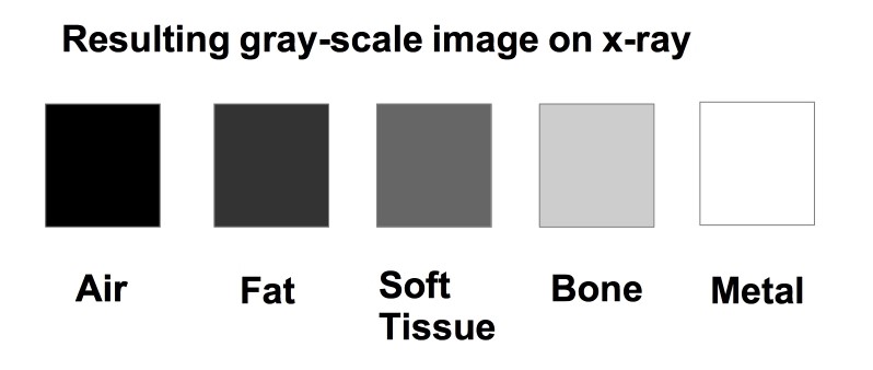 Appearance-of-different-entities-on-x-ray.jpg