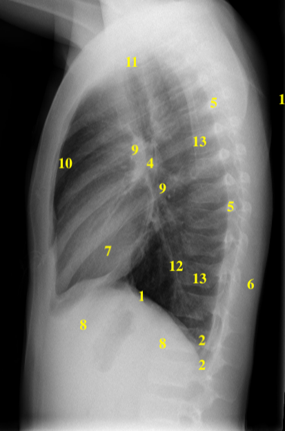 Lateral Thoracic Spine X Ray