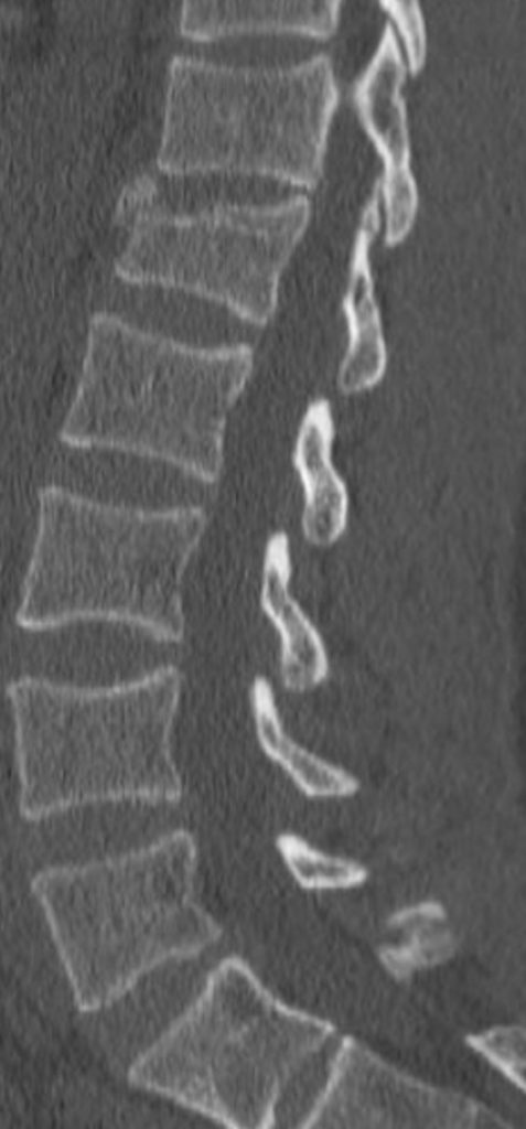 brain-and-spine-case-8-2-477x1024.jpg
