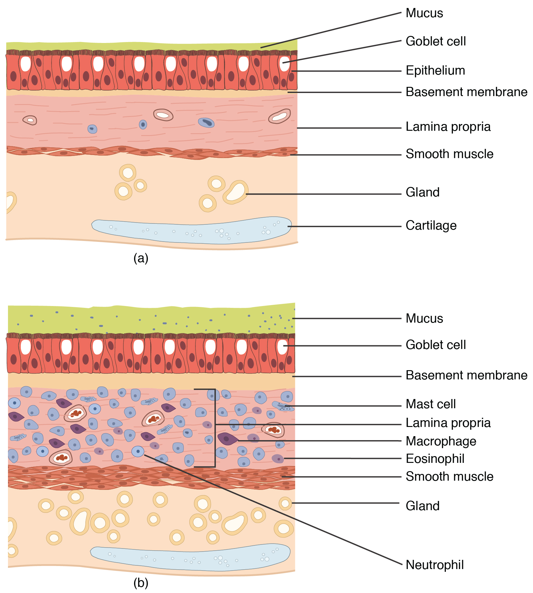 Comparison of normal and asthmatic bronchial tissue.