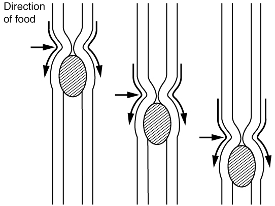 Drawing showing sequential narrowing of a tube, pushing content down the tube, representing peristalsis.